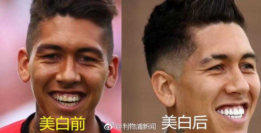 牙医罗比-休斯手持牙齿色卡，脸上露出无奈又自豪的笑容，似乎在回忆菲尔米诺指着色卡最顶端要求‘maximo’时的情景。